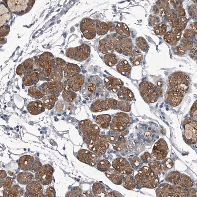 Anti-TPD52L1 antibody produced in rabbit