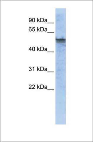 Anti-TPH2 antibody produced in rabbit