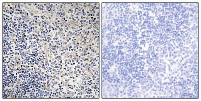 Anti-TPIP1, antibody produced in rabbit