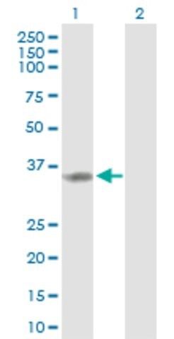 Anti-TP53I3 antibody produced in rabbit