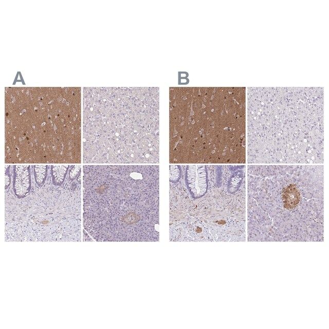 Anti-TPPP antibody produced in rabbit