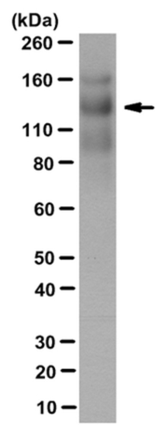 Anti-Thrombospondin-1 Antibody, clone 133