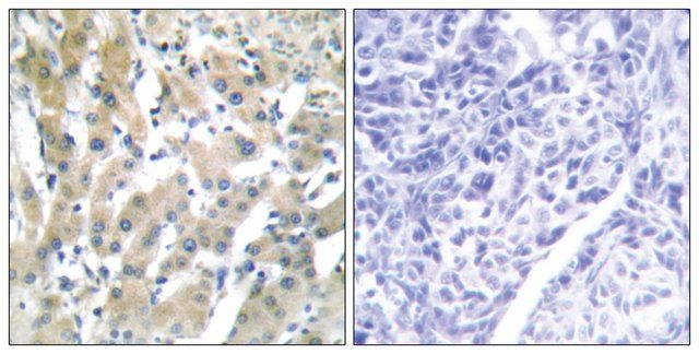 Anti-THRB antibody produced in rabbit