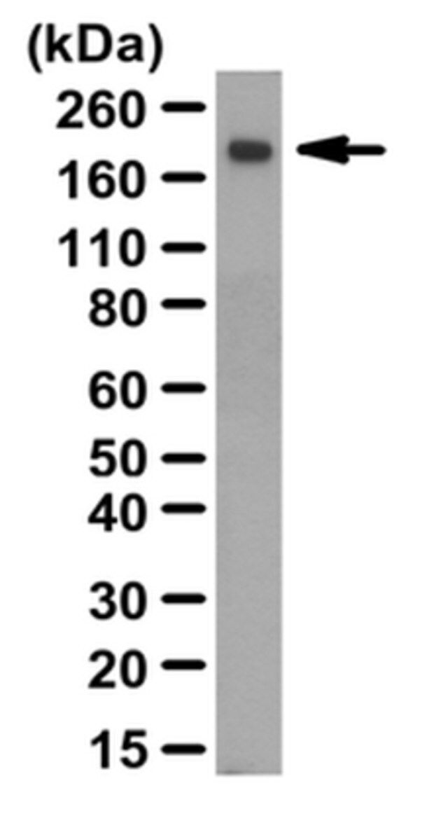 Anti-Thrombospondin-2 Antibody