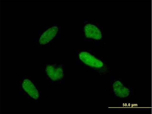 Anti-TIAL1 antibody produced in mouse