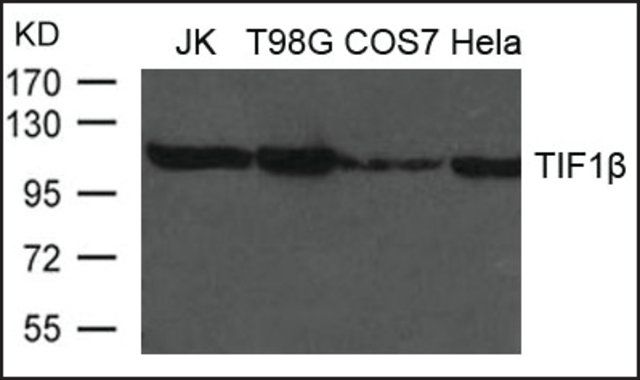 Anti-TIF1 antibody produced in rabbit