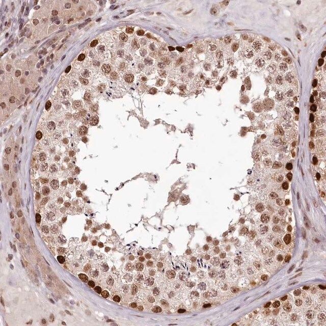 Anti-THYN1 antibody produced in rabbit