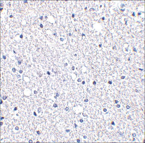 Anti-TIGAR (ab1) antibody produced in rabbit