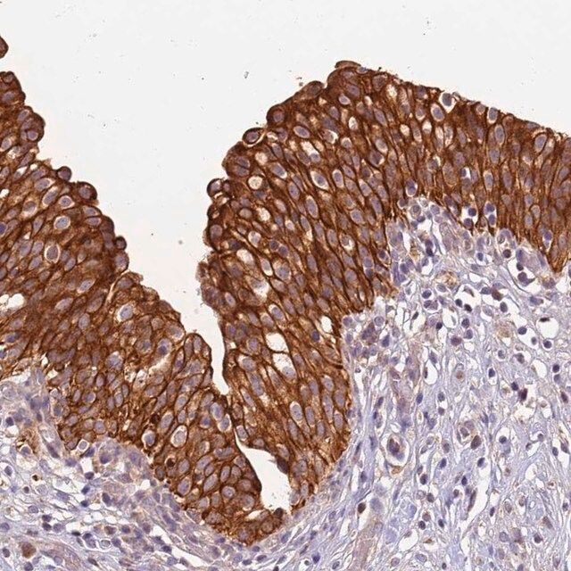 Anti-TIGAR antibody produced in rabbit