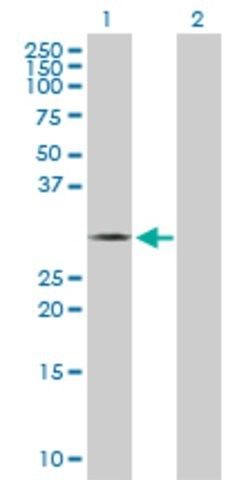 Anti-THTPA antibody produced in rabbit