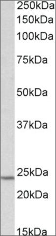 Anti-TIMP1 antibody produced in goat