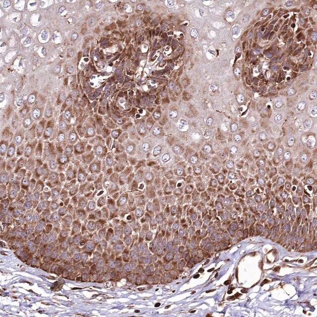 Anti-THUMPD3 antibody produced in rabbit