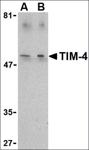 Anti-TIM-4 antibody produced in rabbit