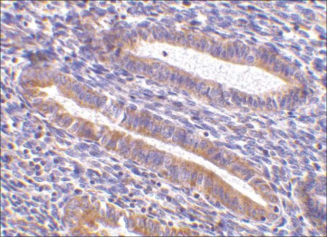 Anti-TIM-1 antibody produced in rabbit