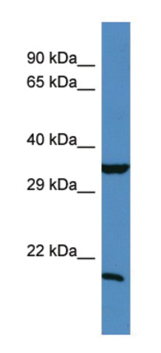 Anti-TIMP1 (N-terminal) antibody produced in rabbit