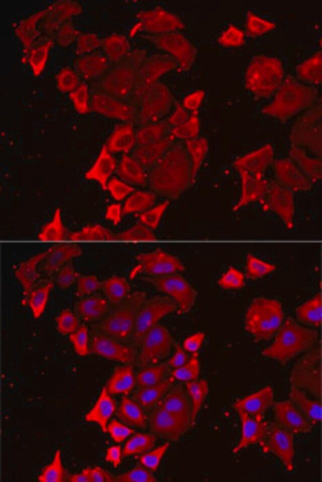 Anti-TIMM17A antibody produced in rabbit