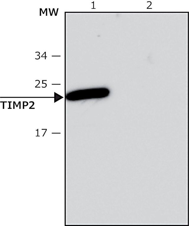 Anti-TIMP2 antibody, Mouse monoclonal