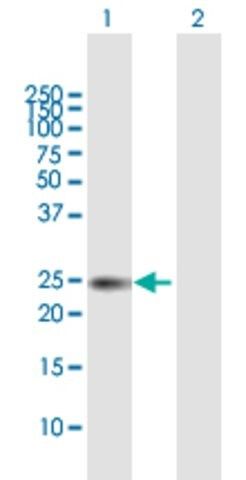 Anti-TIMP1 antibody produced in mouse