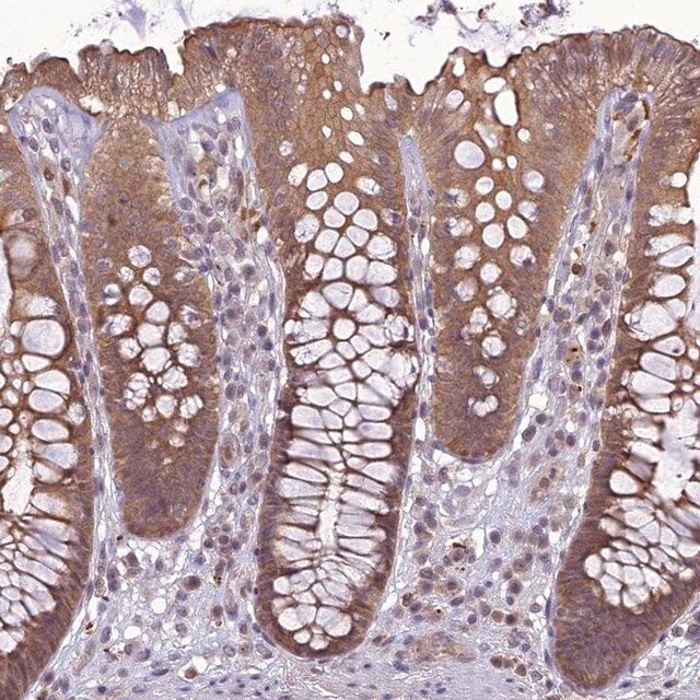 Anti-TIGD7 antibody produced in rabbit