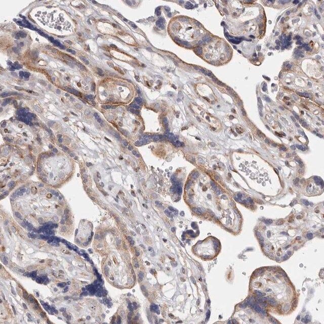 Anti-TIMM17B antibody produced in rabbit