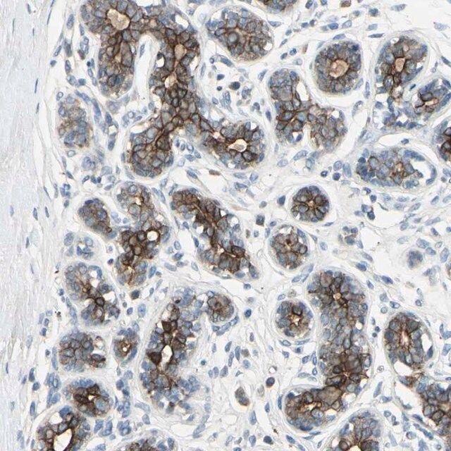 Anti-TIMM21 antibody produced in rabbit