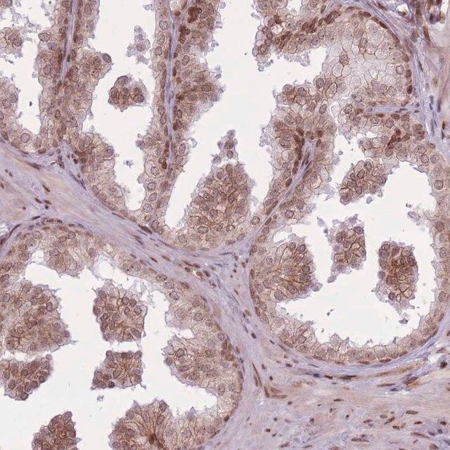 Anti-TMC6 antibody produced in rabbit