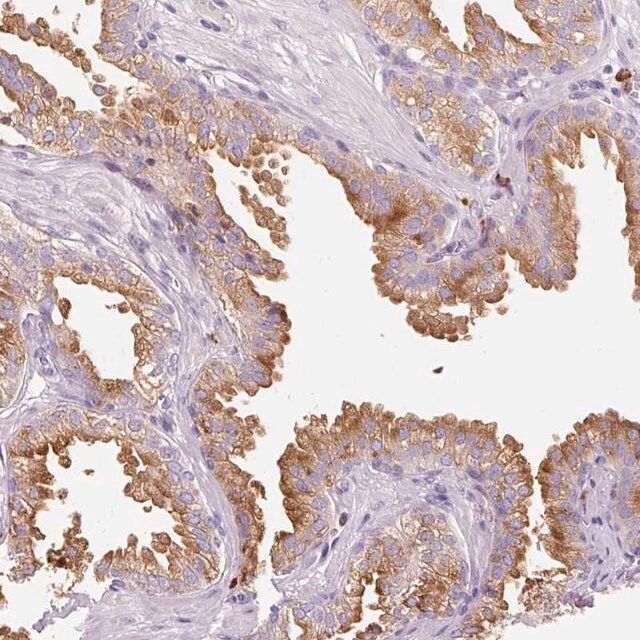 Anti-TMC8 antibody produced in rabbit