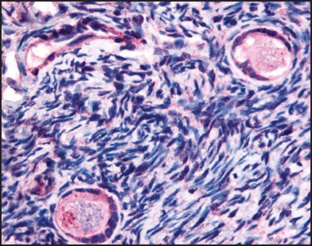 Anti-TMEM5 (AB2) antibody produced in rabbit