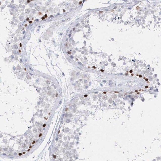 Anti-TMCO6 antibody produced in rabbit