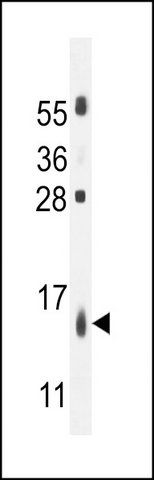 ANTI-TMEM218 (CENTER) antibody produced in rabbit