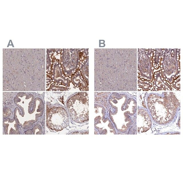 Anti-TMC5 antibody produced in rabbit