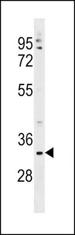 ANTI-TMEM178 (CENTER) antibody produced in rabbit