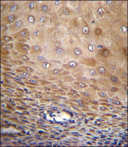 ANTI-TMEM43 (CENTER) antibody produced in rabbit