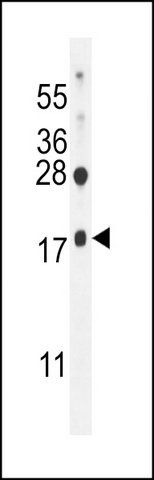 ANTI-TMEM188 (N-TERM) antibody produced in rabbit