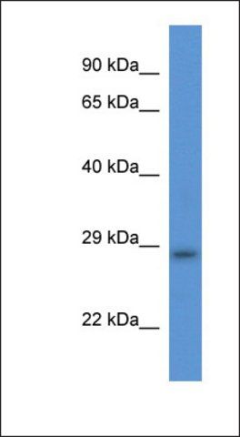 Anti-TMEM33 antibody produced in rabbit