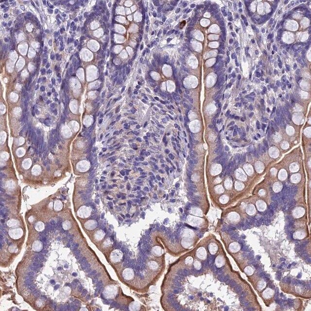 Anti-TMEM171 antibody produced in rabbit