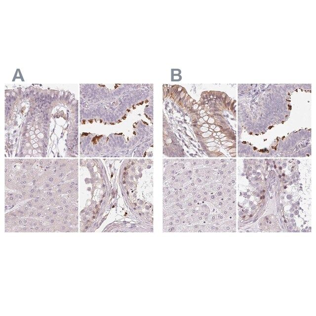 Anti-TMEM237 antibody produced in rabbit