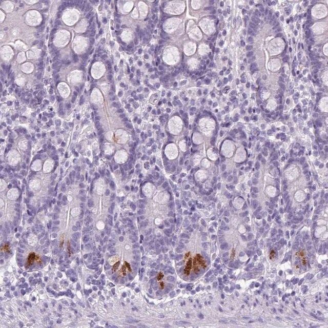 Anti-TMEM91 antibody produced in rabbit