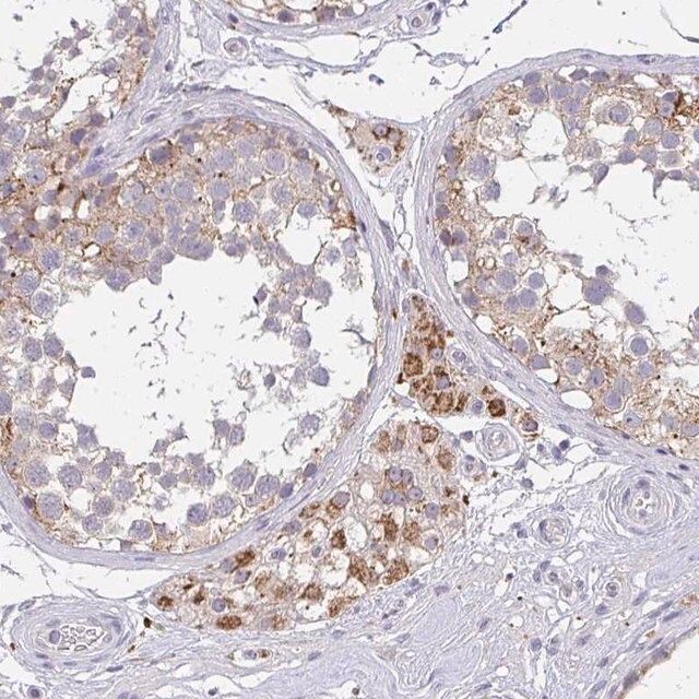 Anti-TMEM219 antibody produced in rabbit