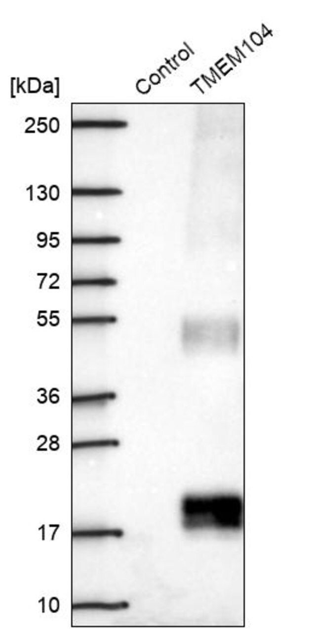 Anti-TMEM104 antibody produced in rabbit