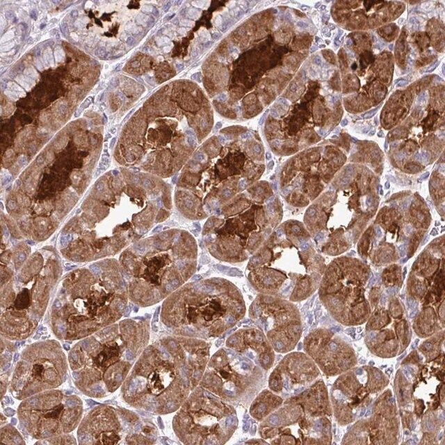 Anti-TMEM110 antibody produced in rabbit