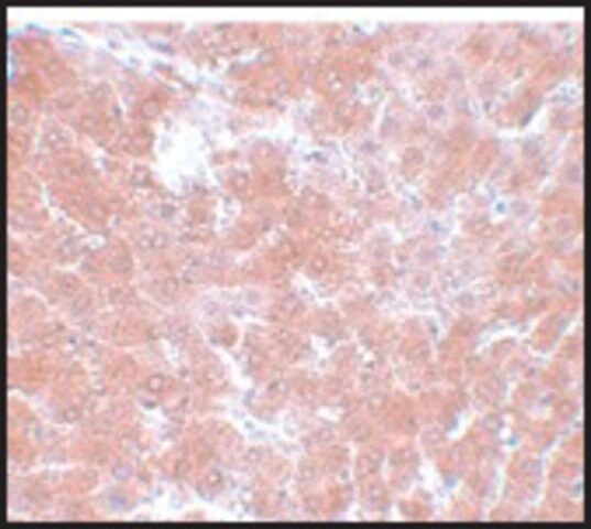 Anti-TMEM70 antibody produced in rabbit