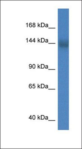 Anti-TMEM2 antibody produced in rabbit