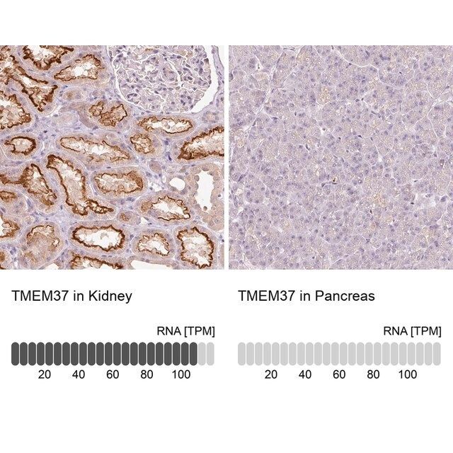 Anti-TMEM37 antibody produced in rabbit