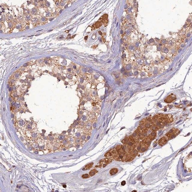 Anti-TMEM258 antibody produced in rabbit