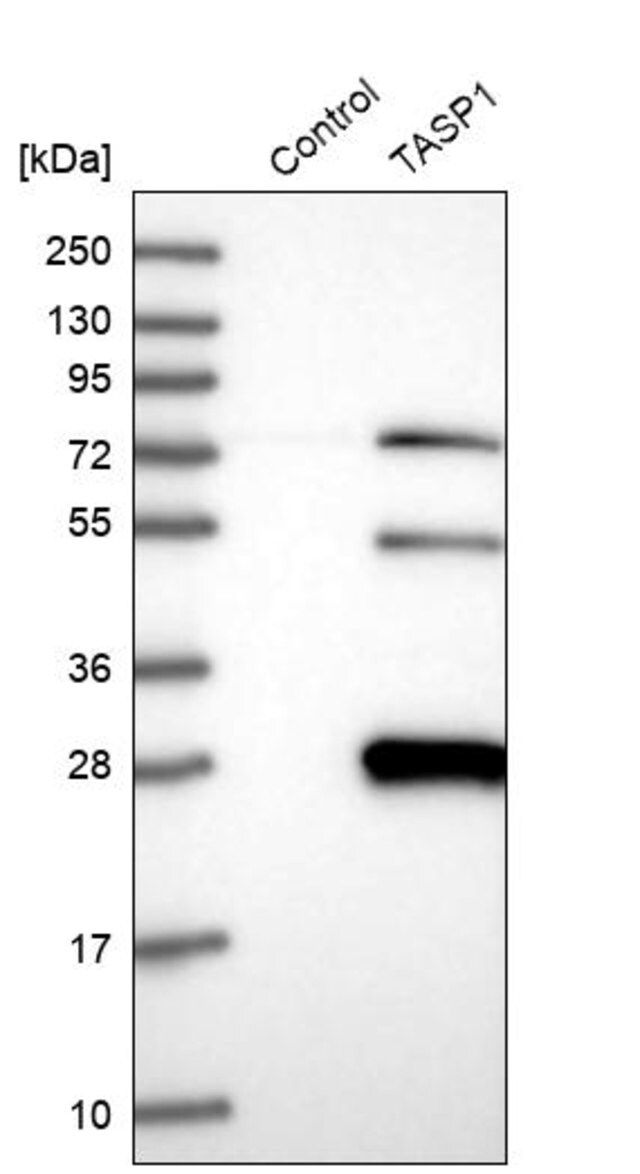 Anti-TASP1 antibody produced in rabbit