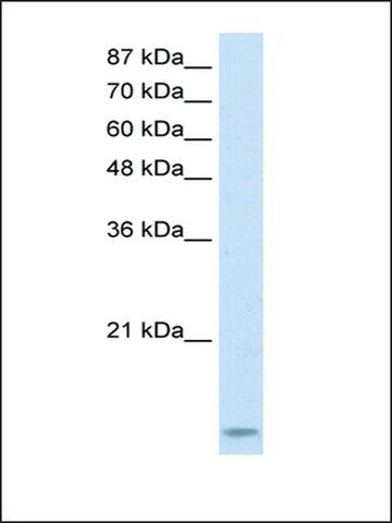 Anti-TARBP2 antibody produced in rabbit