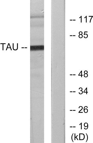 Anti-TAU antibody produced in rabbit