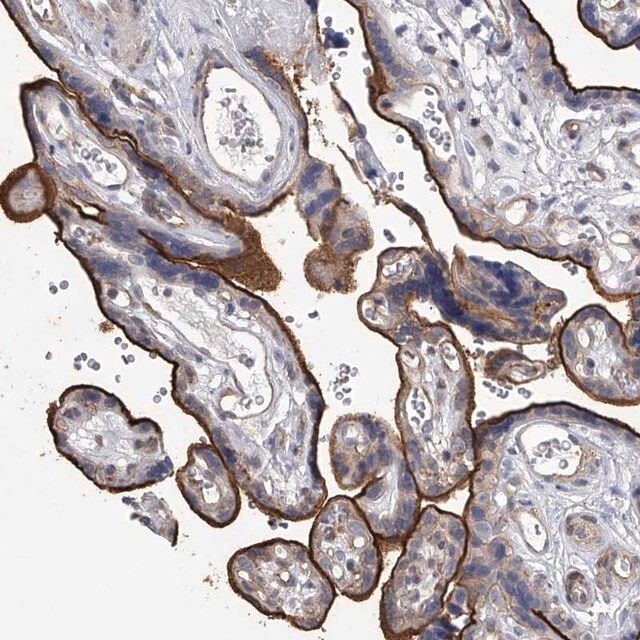 Anti-TASP1 antibody produced in rabbit