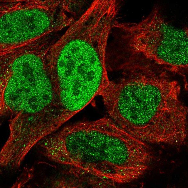 Anti-TATDN2 antibody produced in rabbit